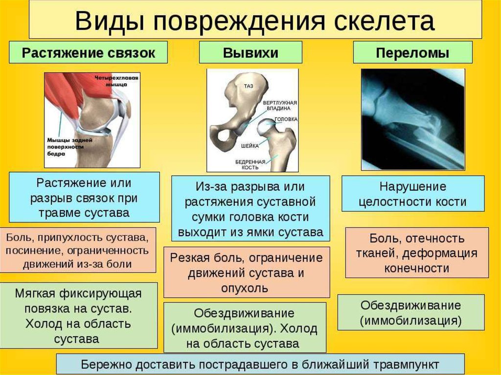 Презентация первая помощь при травмах растяжении связок вывихах суставов переломах костей 8 класс