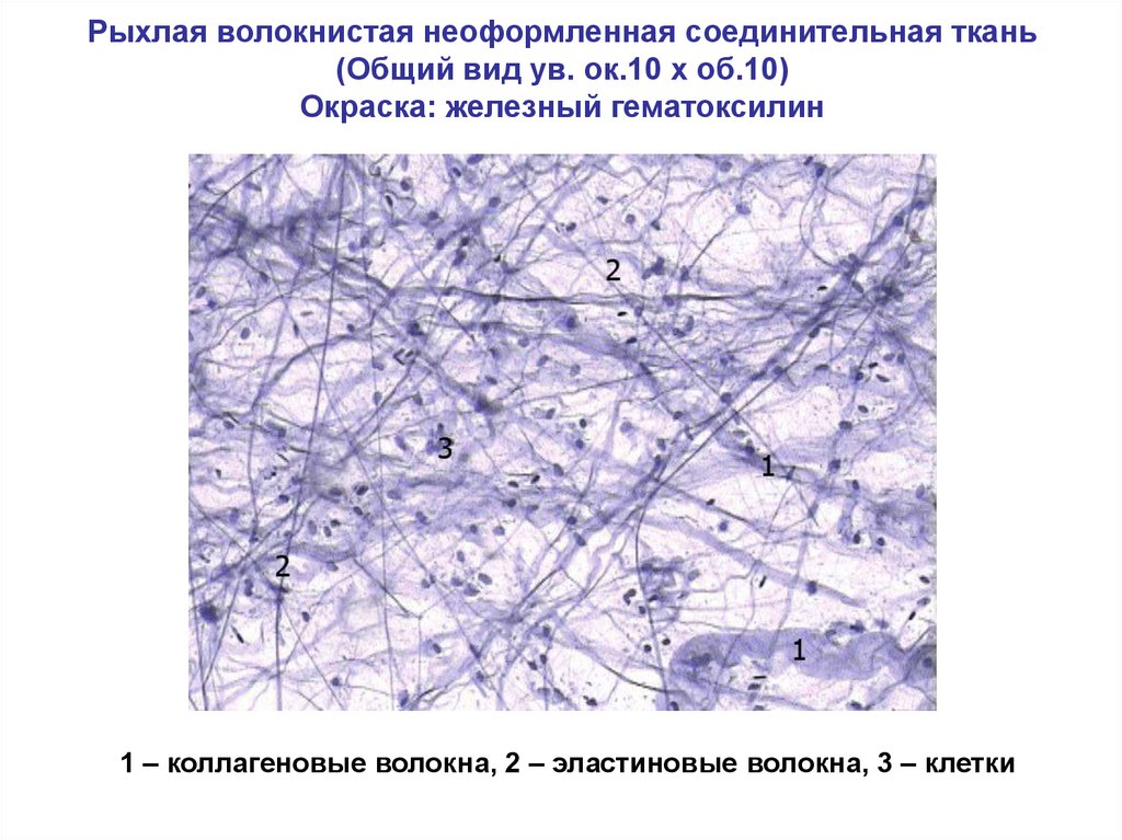 Волокнистая соединительная ткань картинки