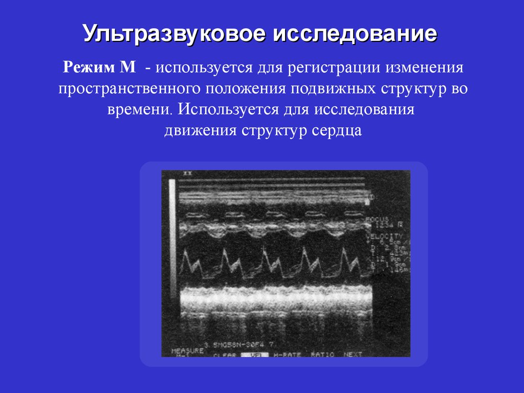 rough neural computing techniques for computing with words