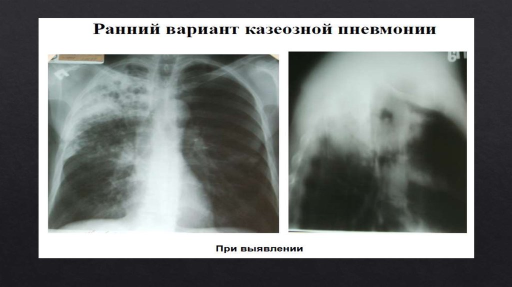 Функциональный сестринский уход 32