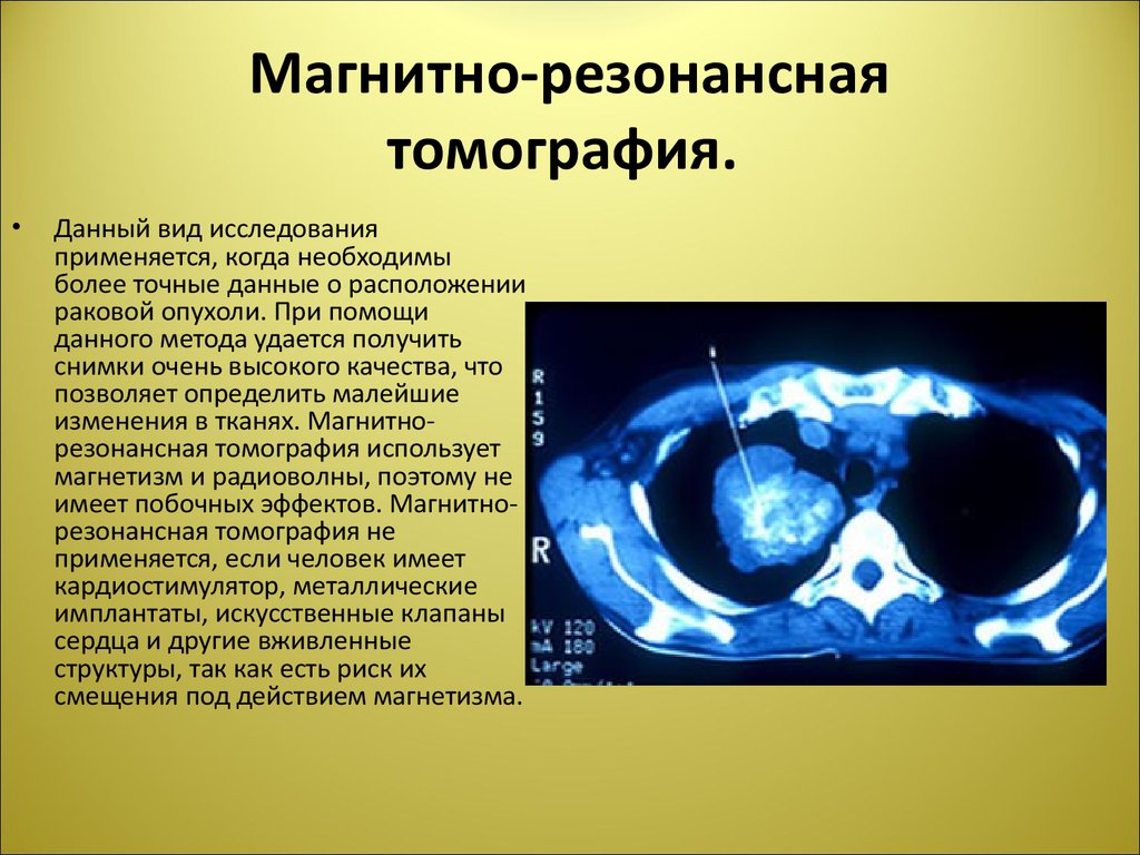 Магнитно-резонансная томография.