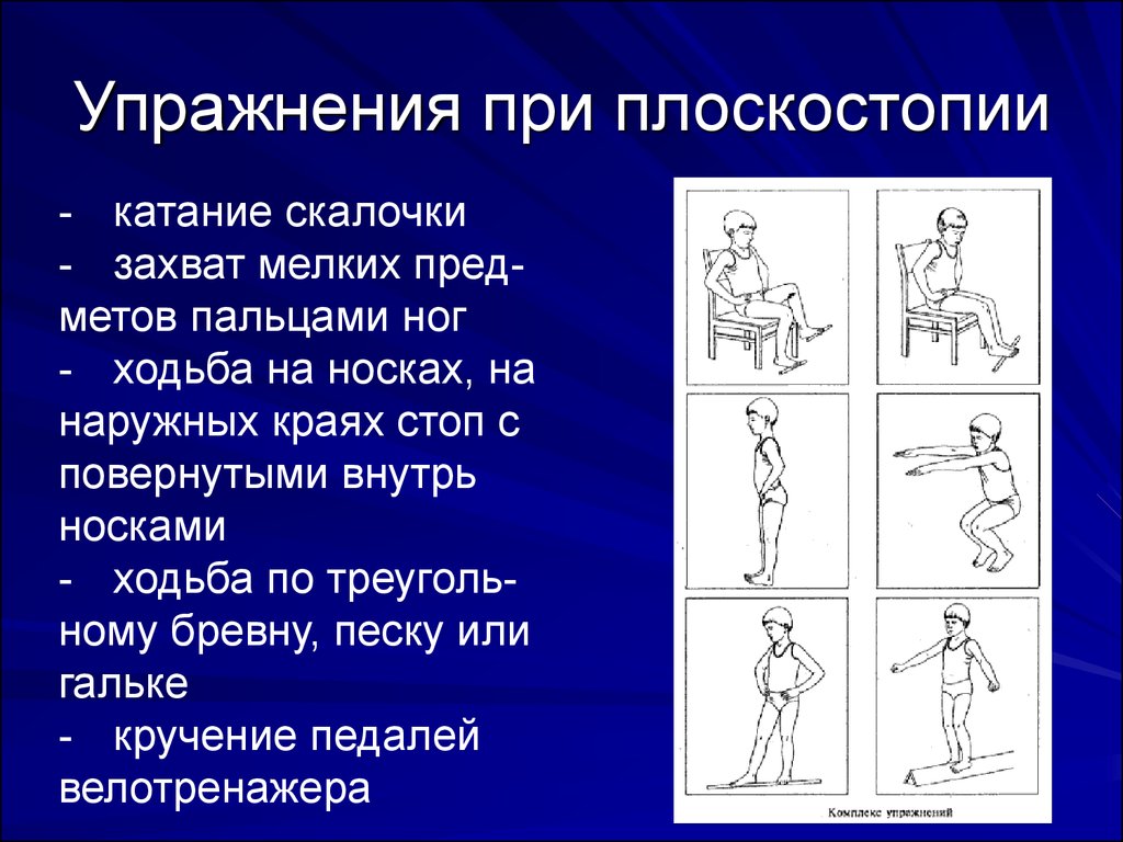 План конспект лфк при плоскостопии