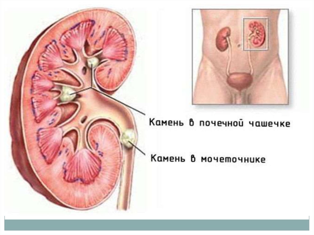 диета 4 при заболеваниях кишечника рецепты блюд диета 4 при заболеваниях кишечника рецепты блюд