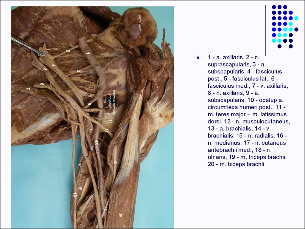 Clinical anatomy of the upper limb - online presentation