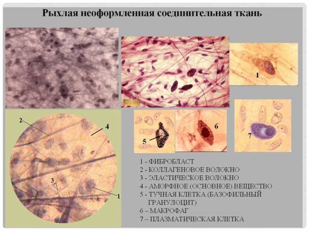 Рыхлая волокнистая неоформленная соединительная ткань рисунок с подписями