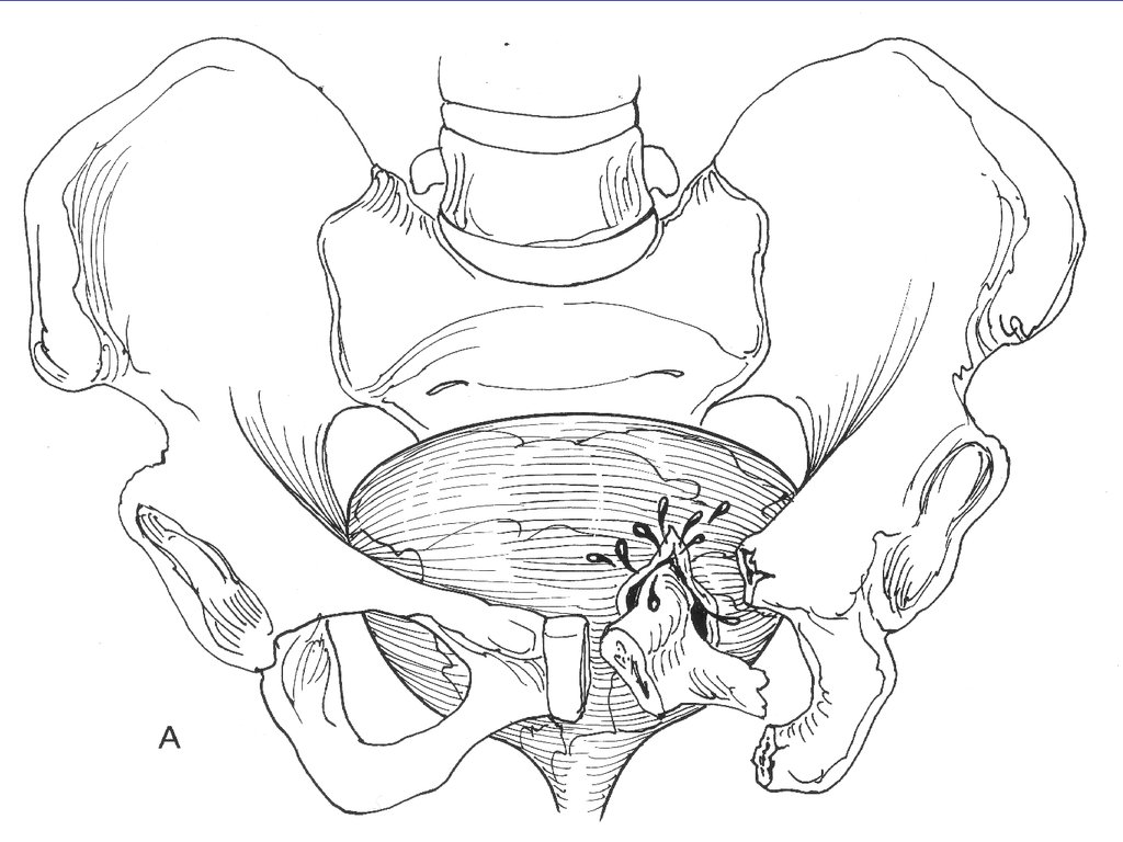 Фото органов малого таза у женщин строение схема
