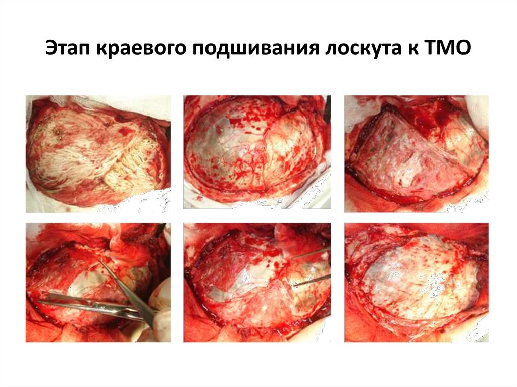 Травмы Черепа Презентация