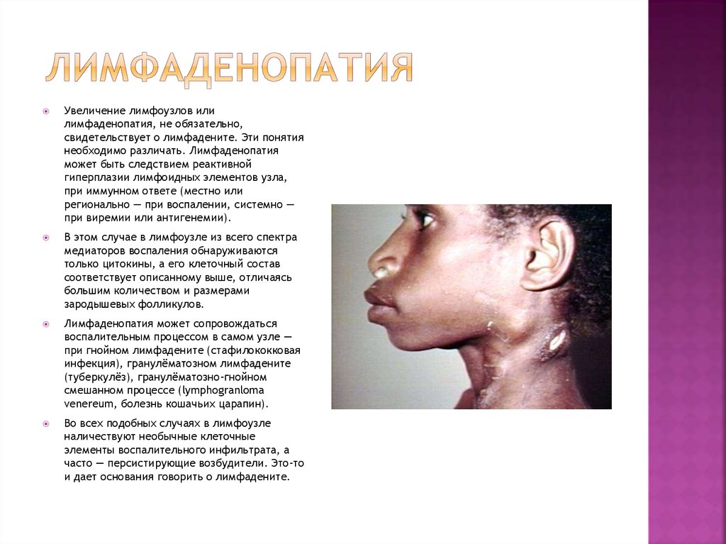 Почему на шее увеличены лимфоузлы Почему на шее увеличены лимфоузлы