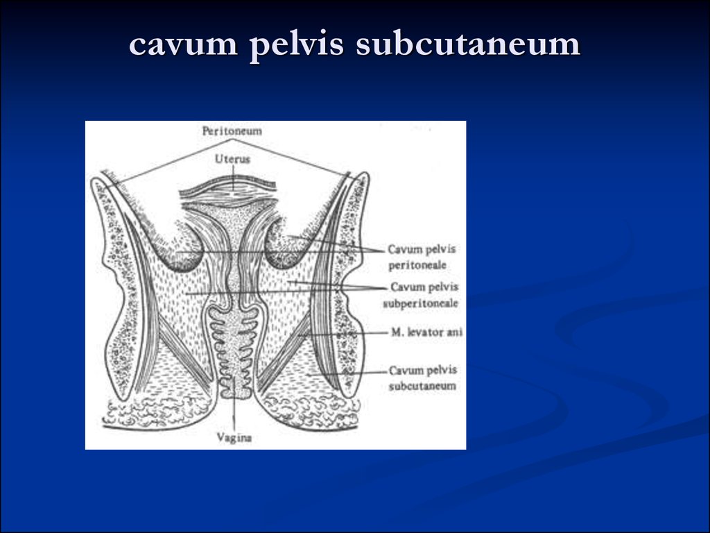 Pelvic аnatomy - презентация онлайн
