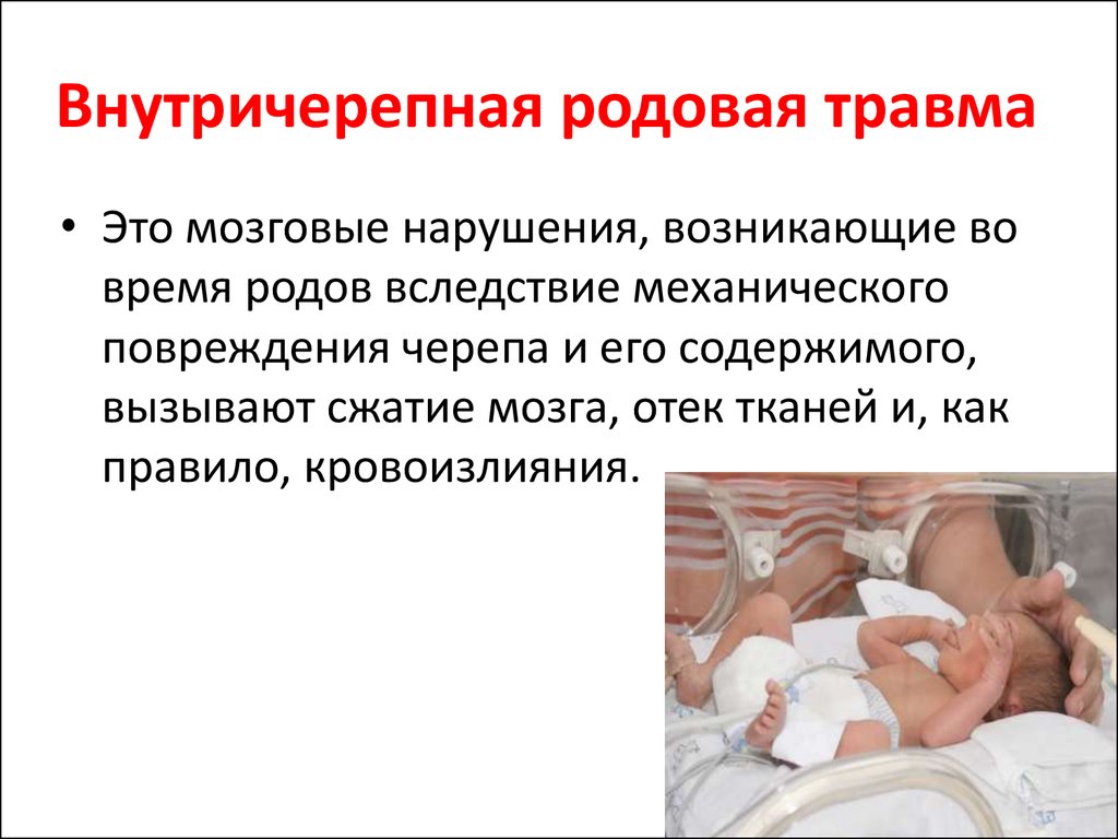 Внутричерепная родовая травма картинки