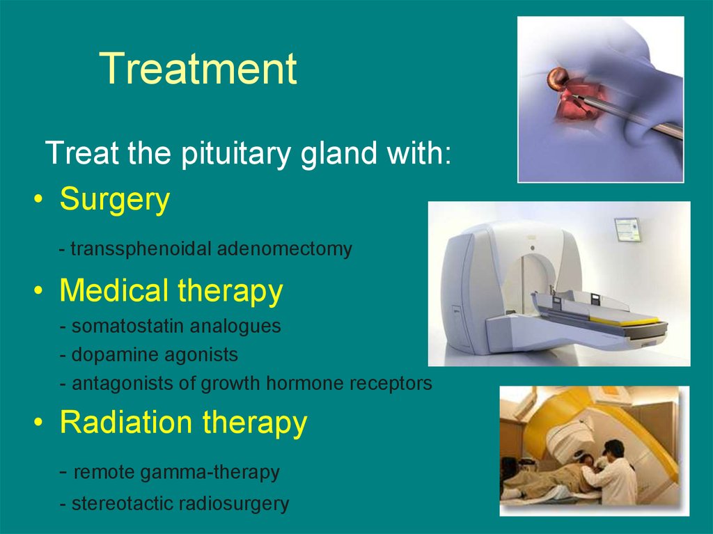 Acromegaly. Description - презентация онлайн