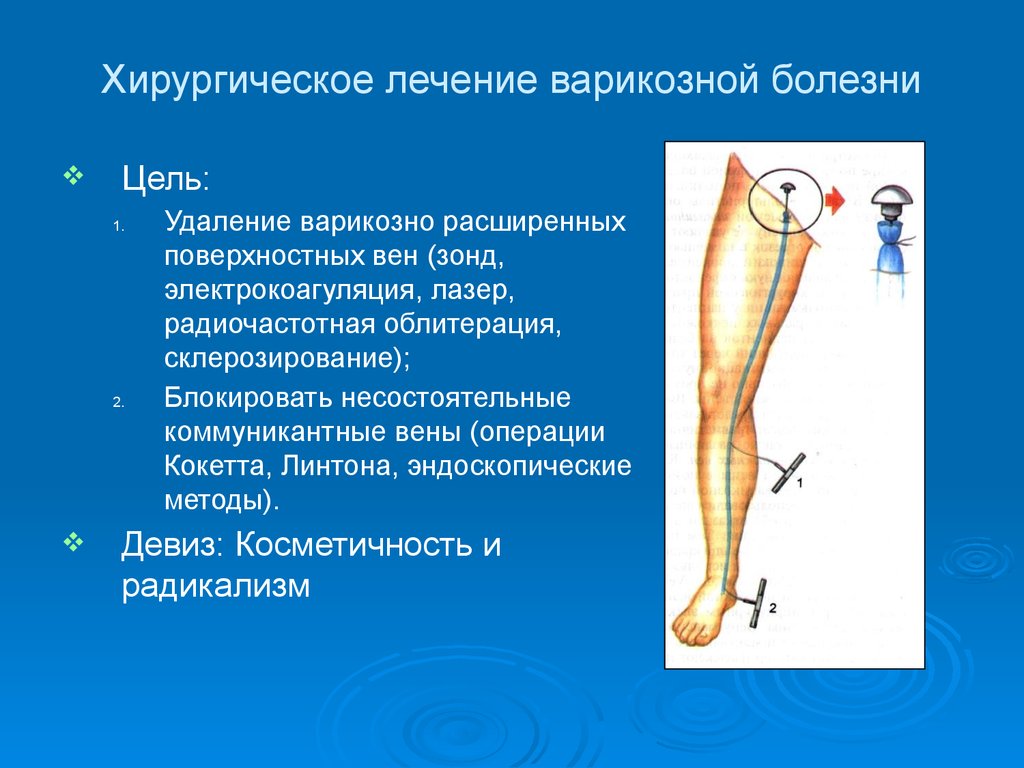Заболевания вен, нижних конечностей - презентация онлайн