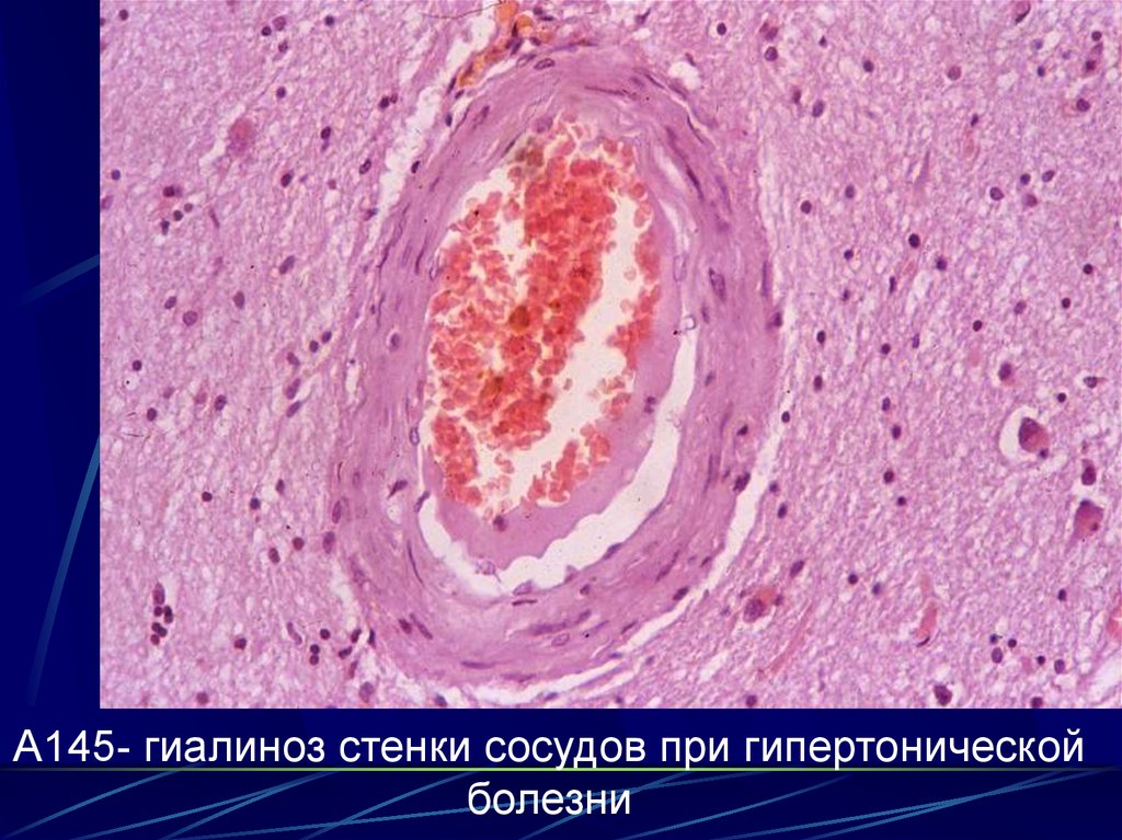 Рвота с кровью и боль в горле