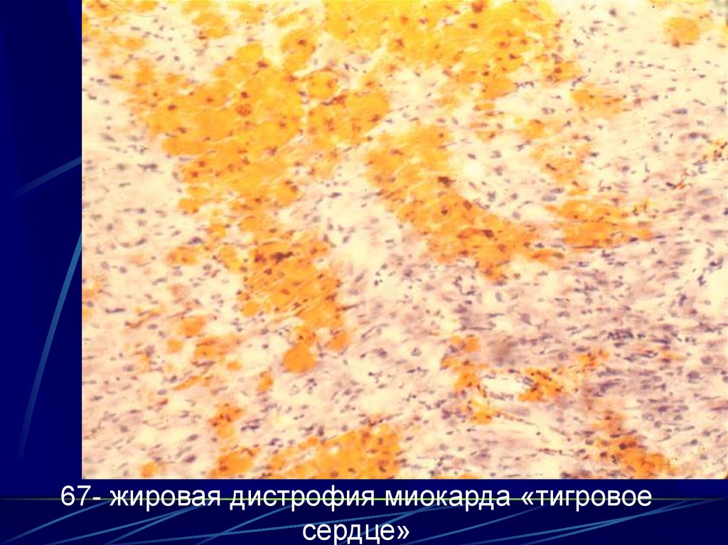 Сон выпали вставные зубы без боли и крови к чему