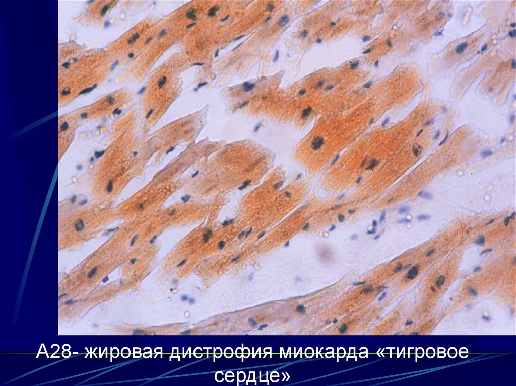 Парацетамол инструкция при головной боли
