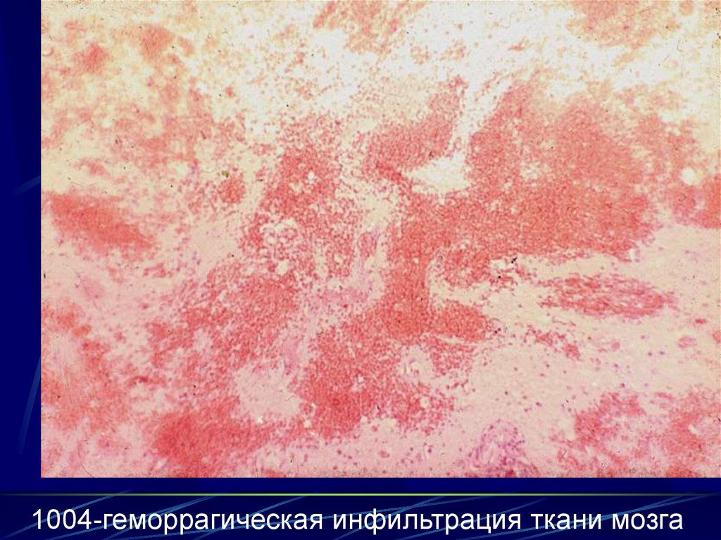 Боль в груди отдает в правый бок