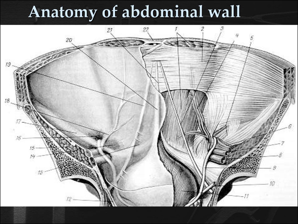 Abdominal wall hernia - презентация онлайн