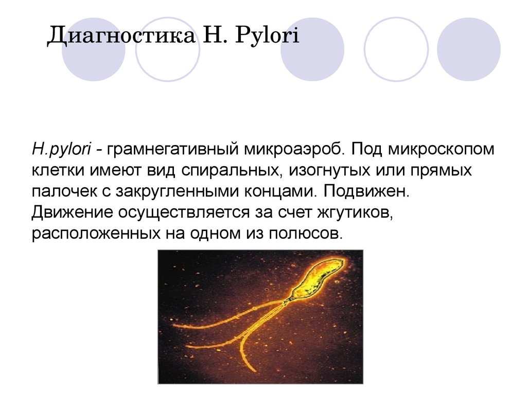 H.pylori - грамнегативный микроаэроб. Под микроскопом клетки имеют вид спиральных, изогнутых или прямых палочек с закругленными концами. Подви