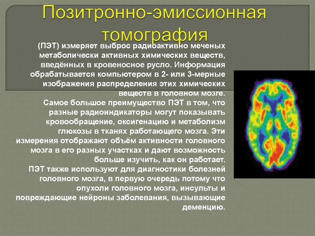 Подготовка К Пэт Кт Исследованию Диета