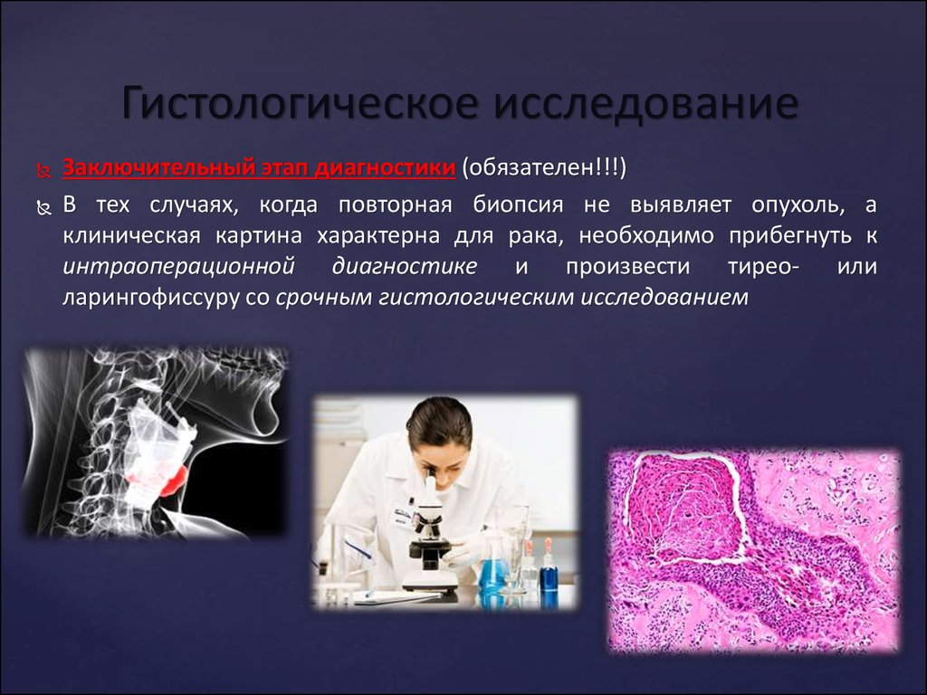 Анализ в гинекологии на онкологию