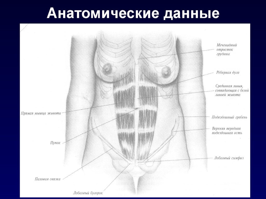 Мечевидный отросток картинка