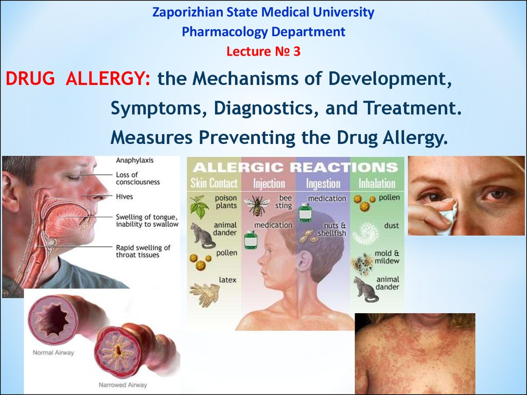 Drug Allergy The Mechanisms Of Development Symptoms Diagnostics And