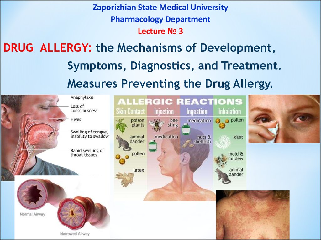 Drug allergy the mechanisms of development, symptoms, diagnostics, and