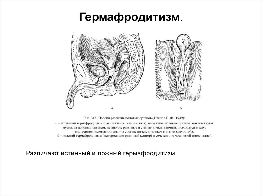 Голая гермафродит показывает половой орган
