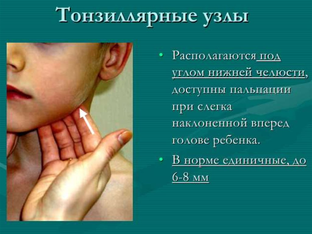 Ветрянка у взрослых история болезни