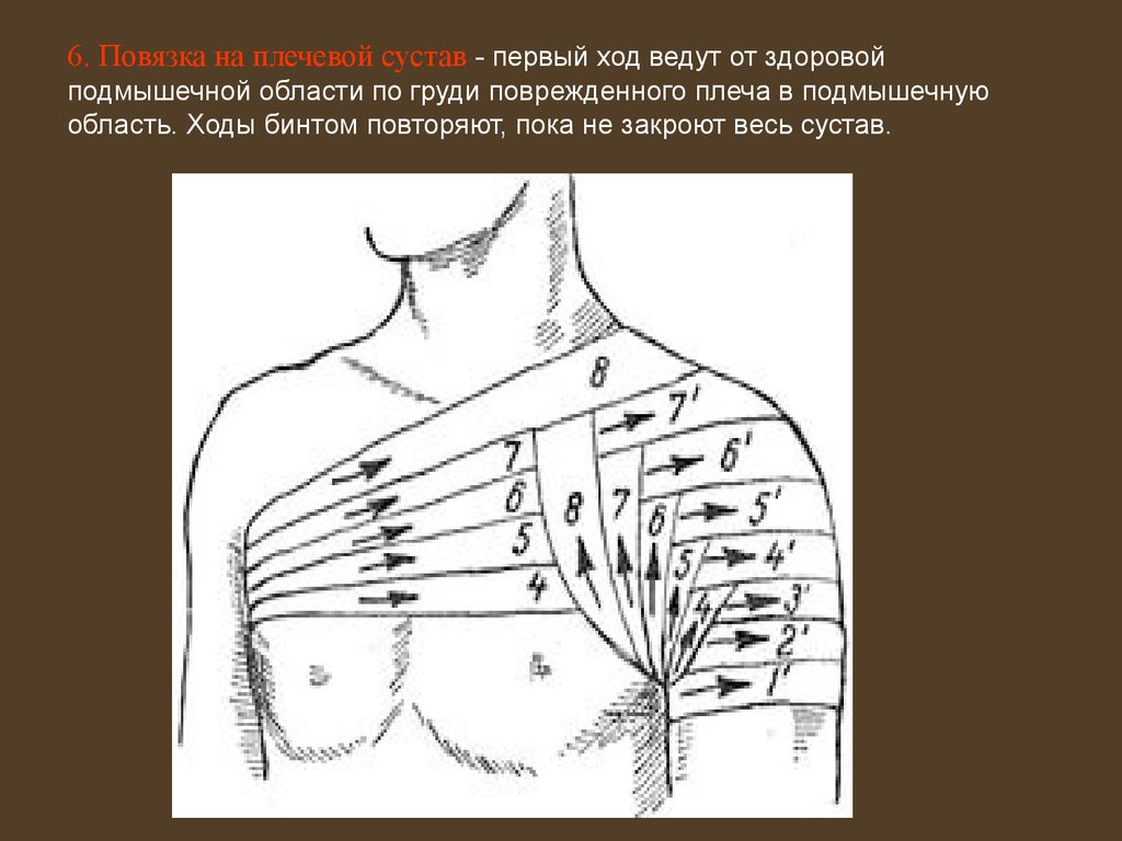 6. Повязка на плечевой сустав - первый ход ведут от здоровой подмышечной области по груди поврежденного плеча в подмышечную область. Ходы би