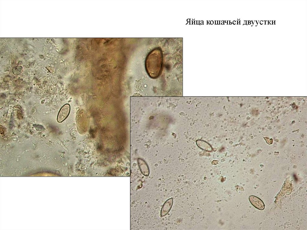 Как выглядят описторхи в кале без микроскопа человека фото