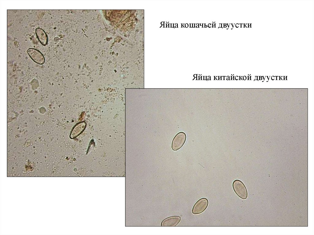 Как выглядят описторхи в кале без микроскопа человека фото