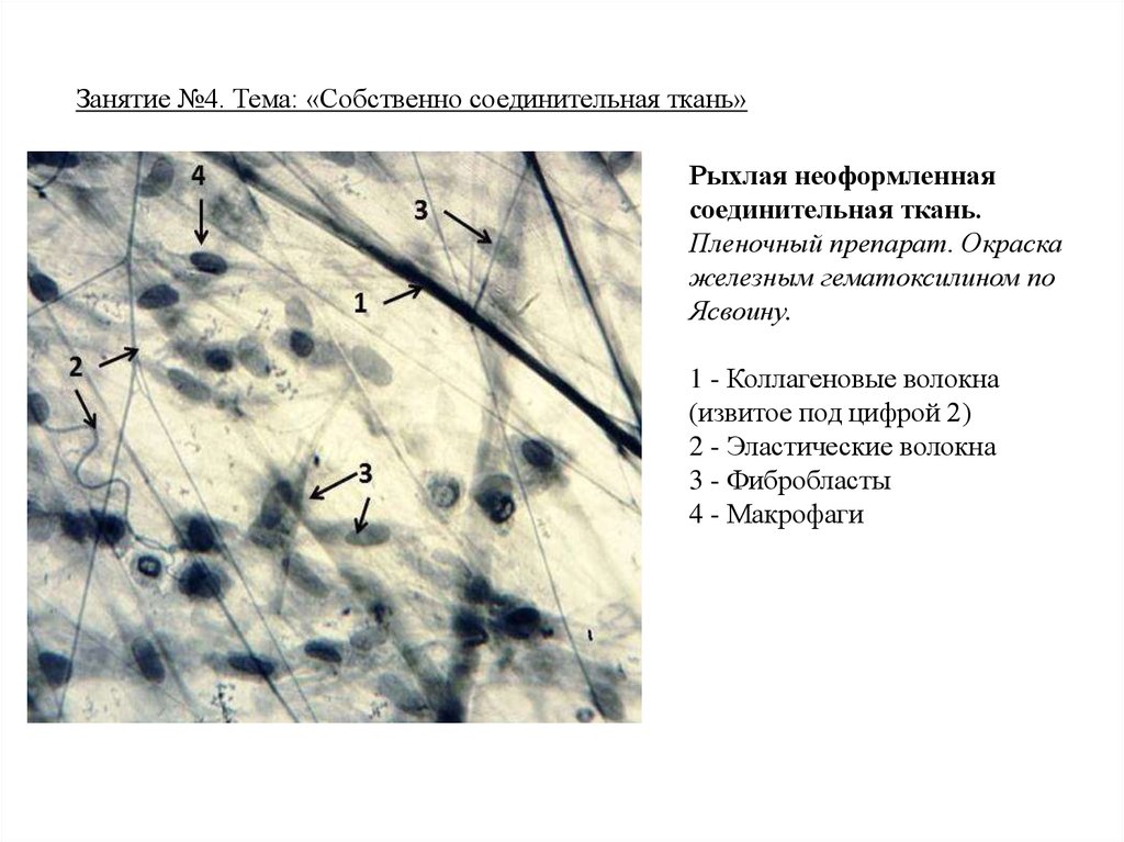 Рыхлая волокнистая неоформленная соединительная ткань рисунок с подписями