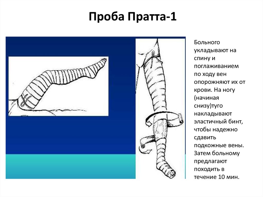 Варикозное Расширение Вен Нижних Конечностей Функциональные Пробы