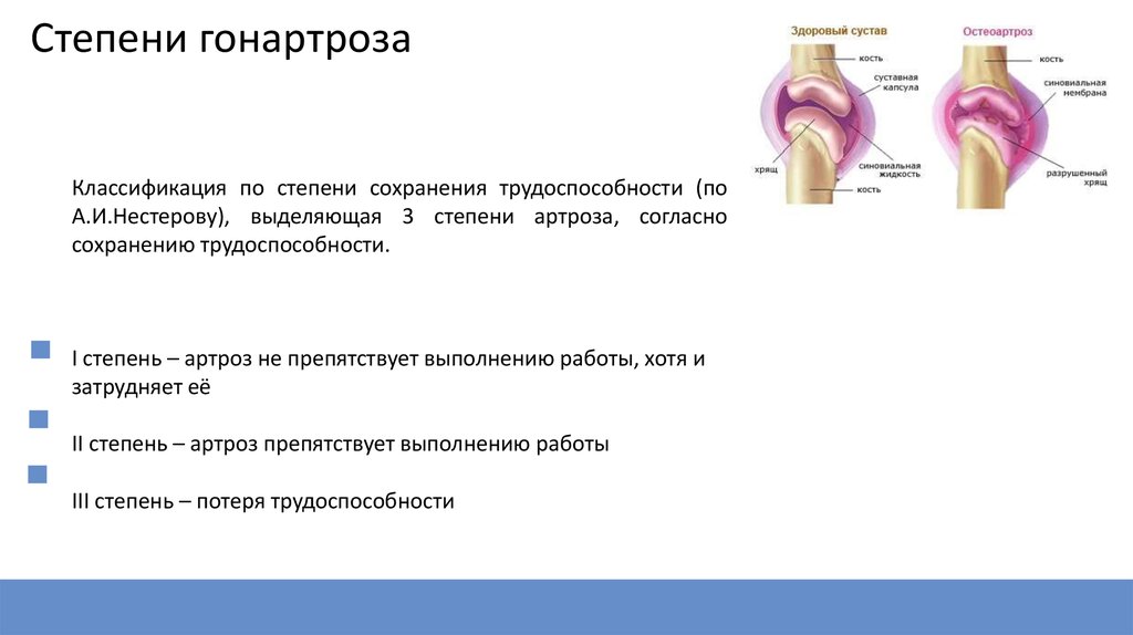 Гонартроз коленного сустава схема лечения