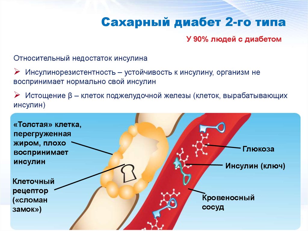 Типы сахарного диабета картинки