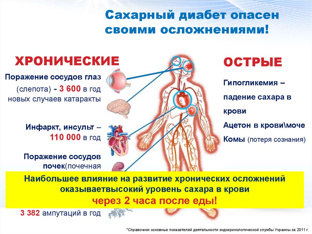 Последствия сахарного диабета картинки