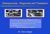 Osteoporosis - Diagnosis and Treatment