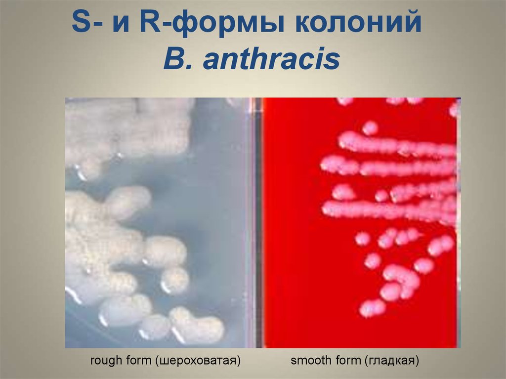 Формы колоний. С И Р формы колоний. R-формы колоний на питательной среде. Риккетсии форма колоний.