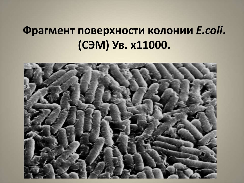 Поверхность отрывки. Гетерогенность микроорганизмов. Гетерогенность бактерий это. Гетерогенность популяций микробов. Гетерогенность микробных популяций.