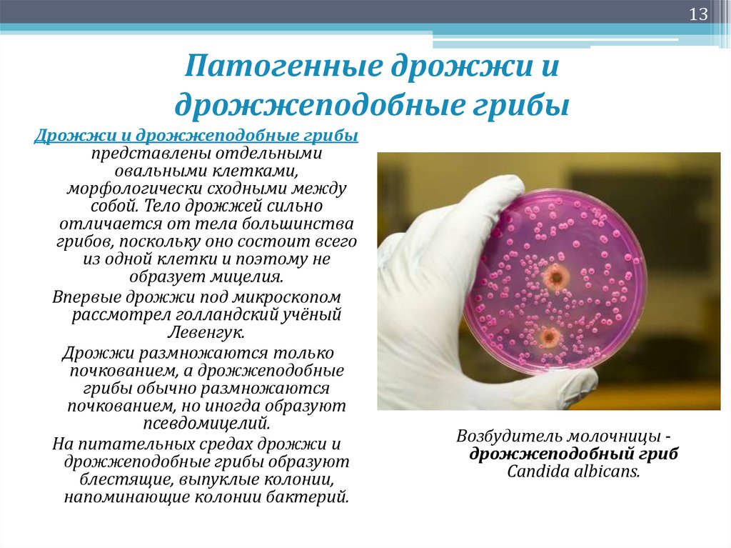 Молочница бактерии. Патогенные дрожжи и дрожжеподобные грибы связь с ВИЧ инфекцией. Заболевания вызываемые патогенными грибами микробиология. Патогенные дрожжеподобные грибы. Заболевания вызываемые дрожжеподобными грибами.