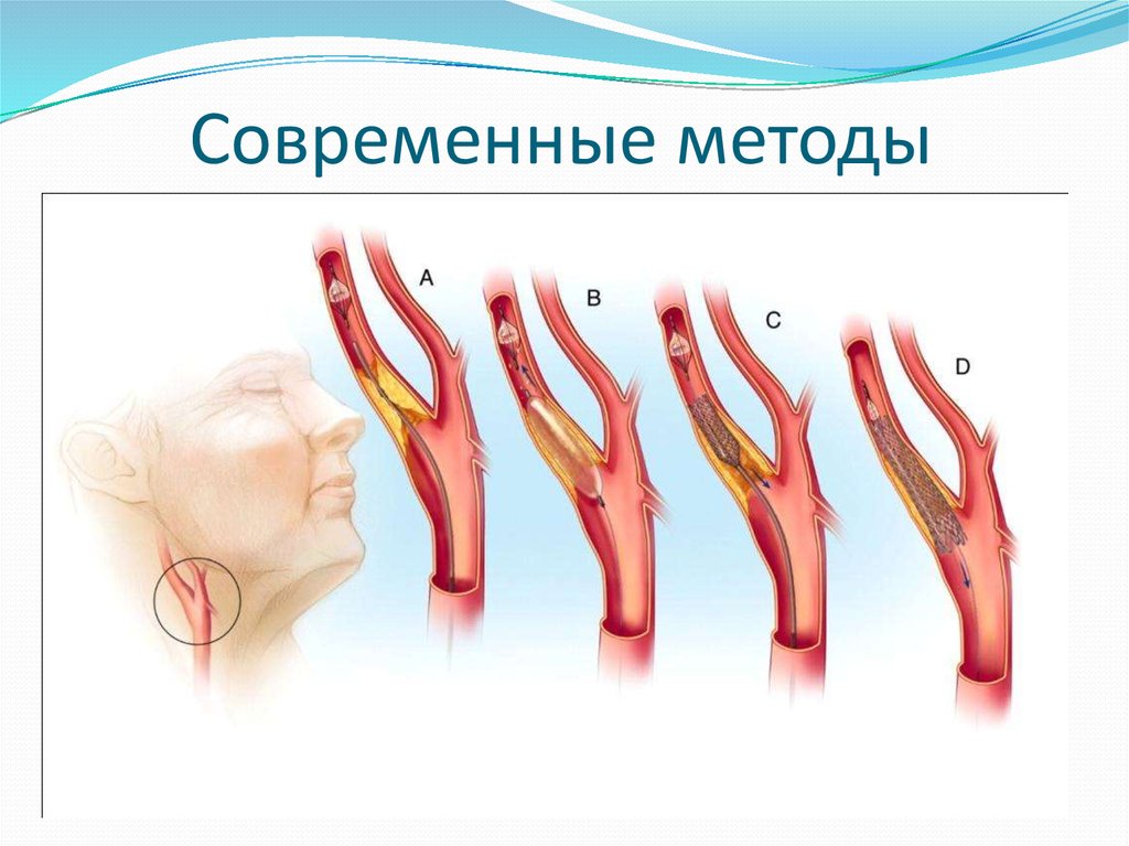 Современные методы
