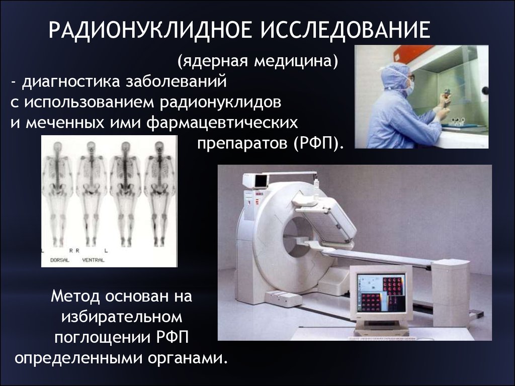 Методы исследования диагностика. Радиофармпрепараты лучевая диагностика. Радионуклидные диагностические исследования. Радионуклидные методы исследования. Радионуклидные методы лучевой диагностики.