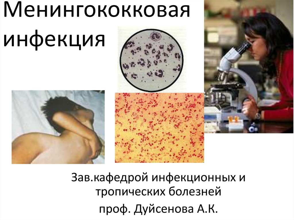 Менингококковвя инфекция - презентация онлайн
