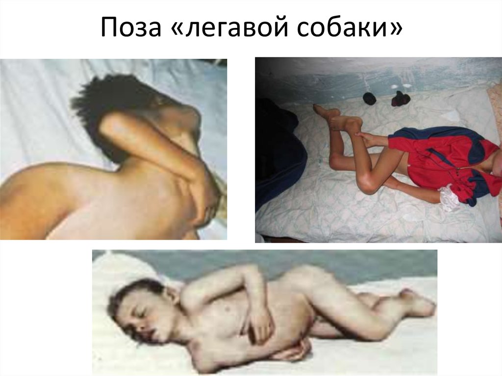 Поза «легавой собаки»