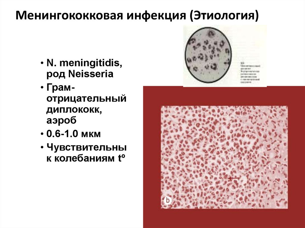 Менингококковая инфекция (Этиология)