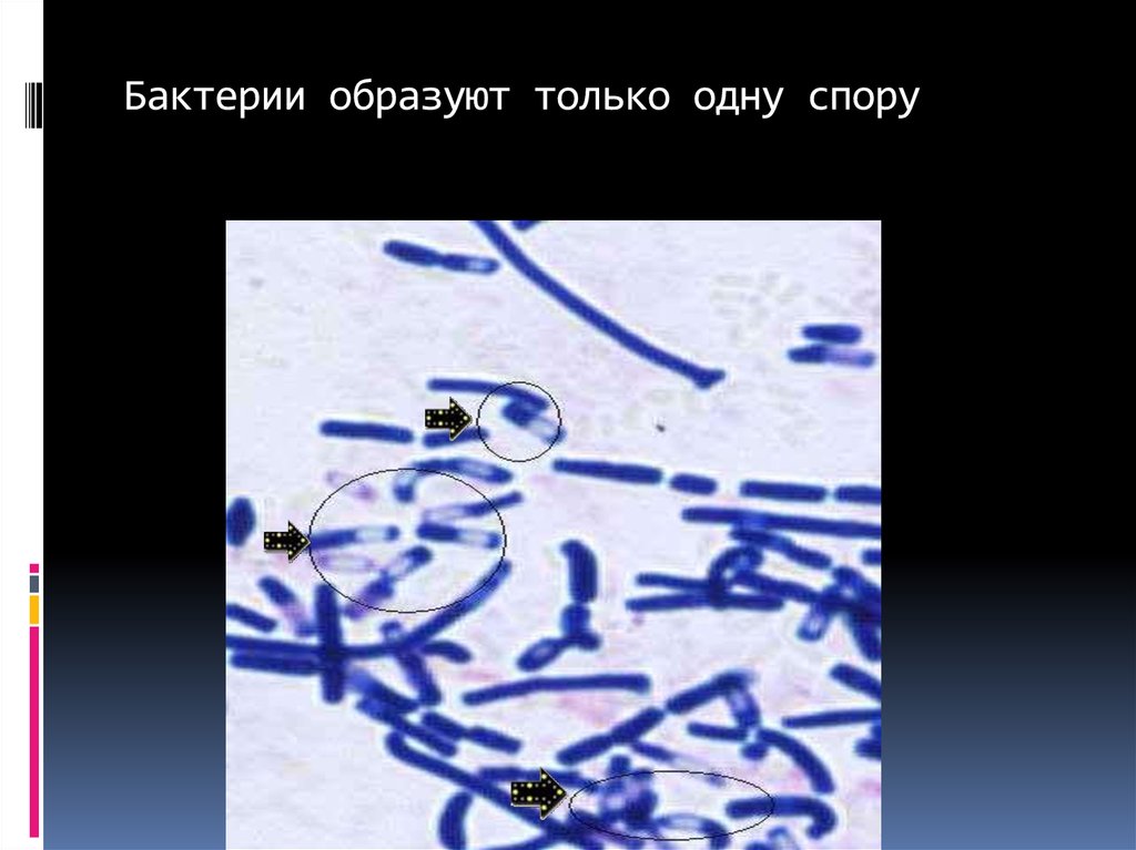 Бактерии образованы гифами. Классификация бактерий по спорообразования. Классификация бактерий по споры. Метанообразующие бактерии морфология. Метанообразующие бактерии классификация.