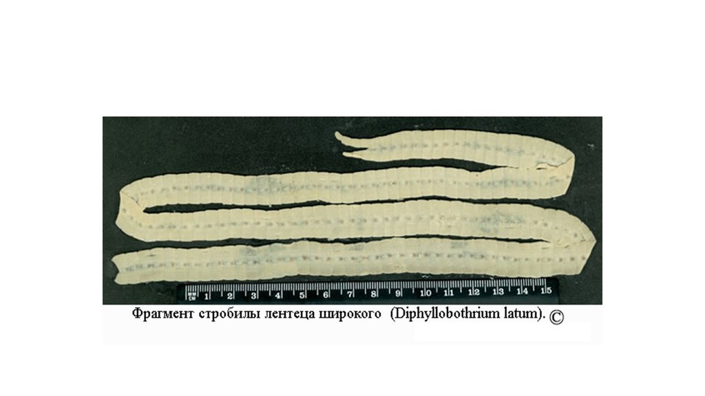 Ленточные и плоские черви. Класс ленточные черви Cestoidea. Ленточные черви широкий лентец. Источник инвазии широкий лентец.