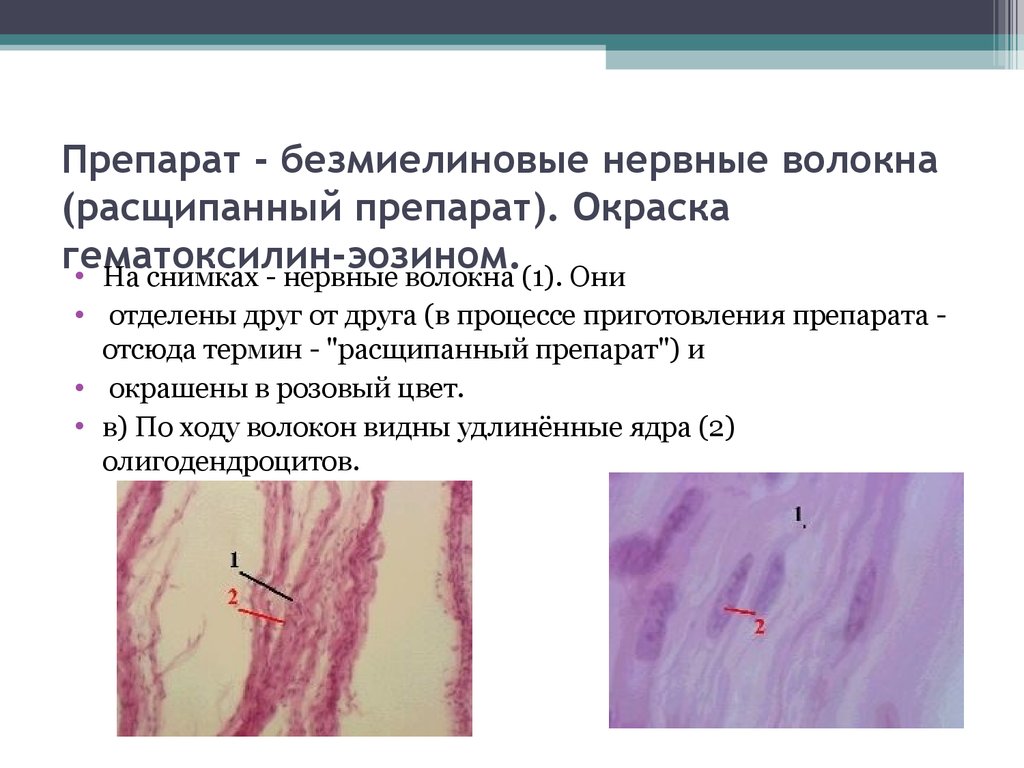 Безмиелиновые нервные волокна гистология рисунок