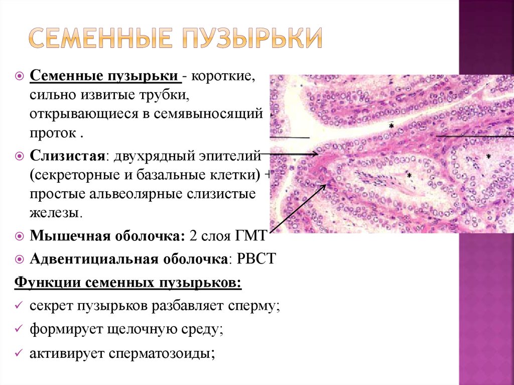 Микроскопическое исследование предстательной железы. Семенные пузырьки гистология. Строение предстательной железы гистология. Семявыносящий проток строение гистология. Семенные пузырьки строение гистология.